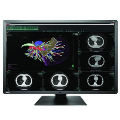 Медицински монитор eizo radiforce rx660 6mp, 30 инча, 3280 x 2048, цветен, eizo-rx660