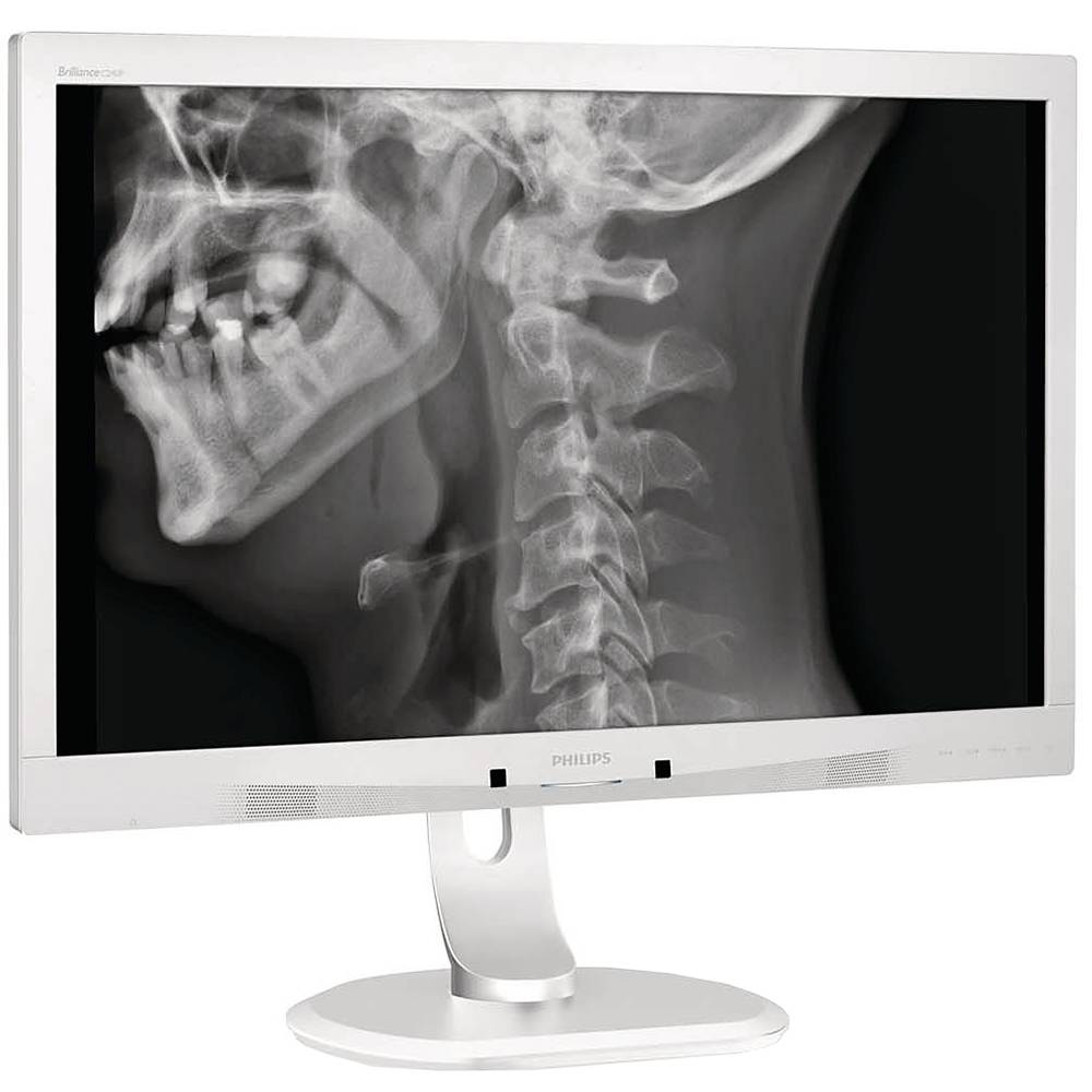 Монитор philips 24 инча, wled ips, clinical monitor, резолюция